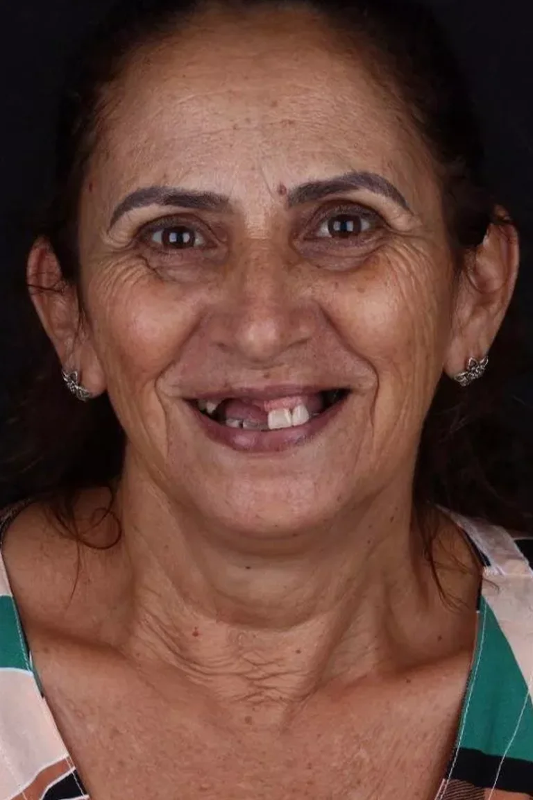 Antes